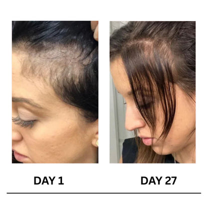 Scalpy Boost+ Hair Growth